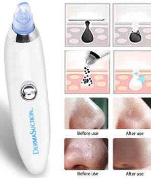 Pore Cleaner Derma Suction